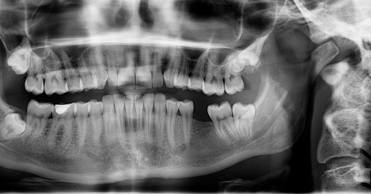 Woman smiling with healthy, white teeth